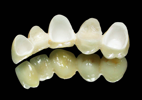 All-ceramic zirconia